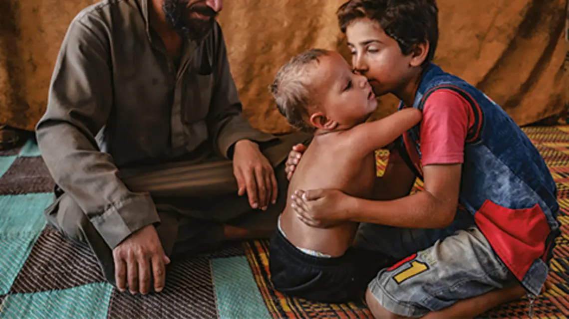 Trzyletni Esyef urodził się bez rąk i nóg. Razem z rodziną mieszka w obozie dla uchodźców w Idlibie fot. Muhammed Abdullah/Anadolu Agency-Getty Images